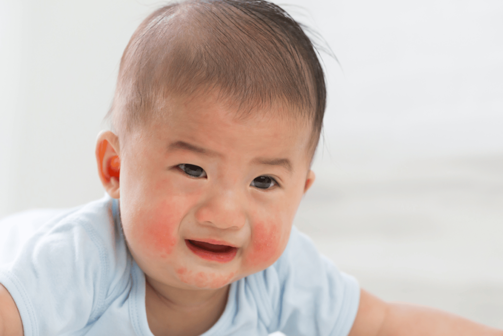 Introduire Allergènes bébé